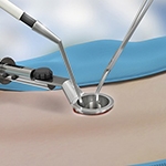 Minimally Invasive Spine Surgery: A Smarter Path to Recovery